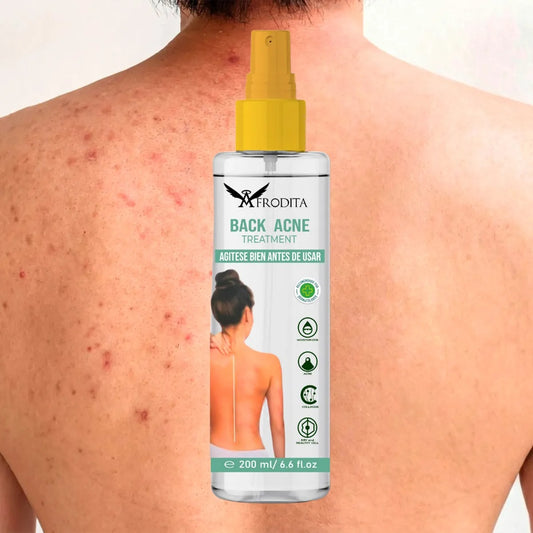 Spray elimina acne